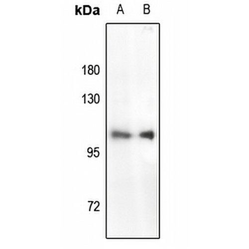 RB1 (Phospho-S780) Rabbit Polyclonal Antibody