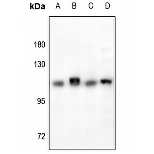 RB1 Rabbit Polyclonal Antibody