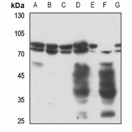 Radixin Rabbit Polyclonal Antibody