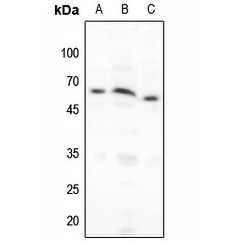 NF-kappaB p65 (Phospho-S276) Rabbit Polyclonal Antibody