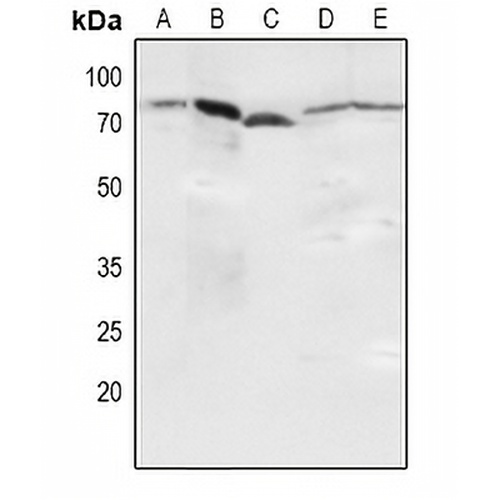 NF-kappaB p65 (Phospho-S536) Rabbit Polyclonal Antibody