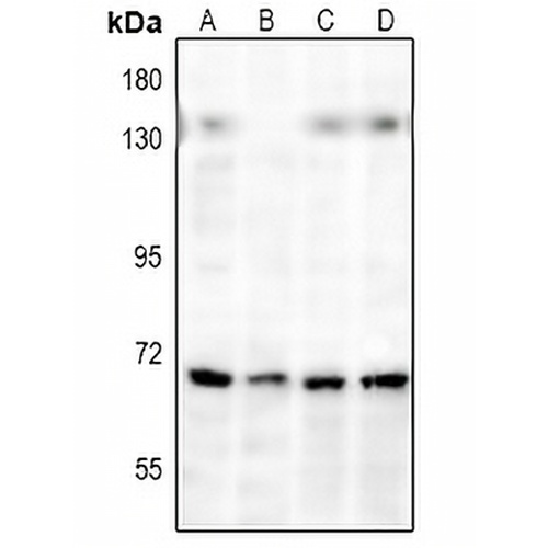 NF-kappaB p65 Rabbit Polyclonal Antibody