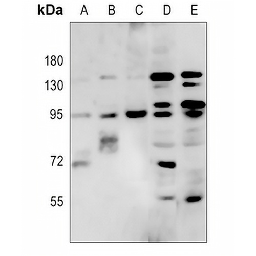 RFX3 Rabbit Polyclonal Antibody