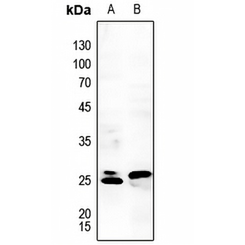 RGS1 Rabbit Polyclonal Antibody