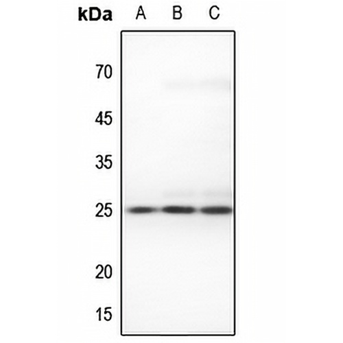 RIT1 Rabbit Polyclonal Antibody