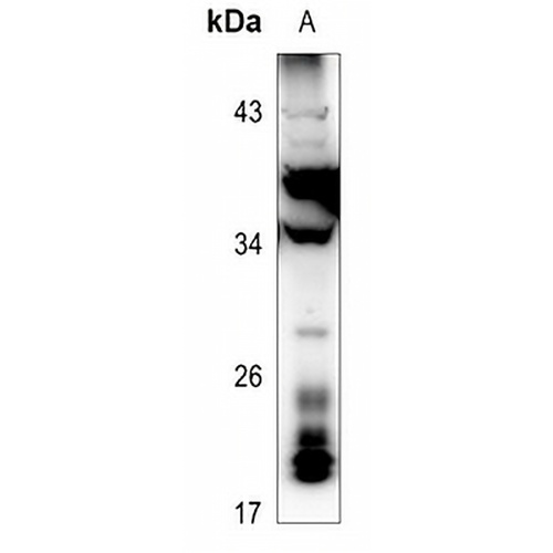 RNASE3 Rabbit Polyclonal Antibody