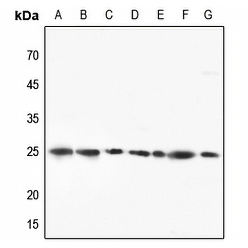RPL10 Rabbit Polyclonal Antibody