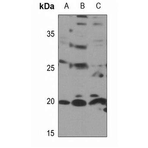 RPL11 Rabbit Polyclonal Antibody