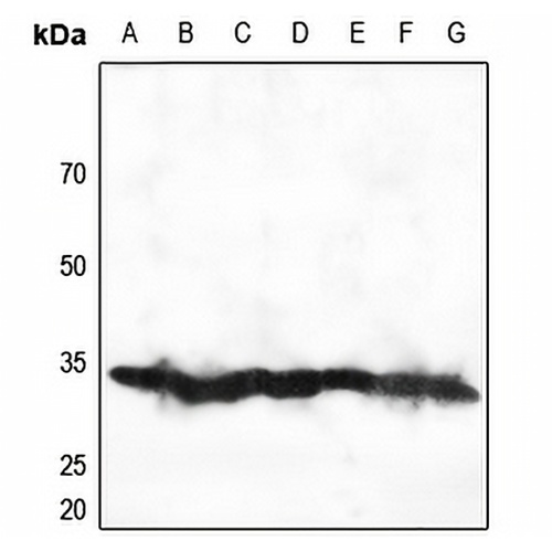 RPS2 Rabbit Polyclonal Antibody
