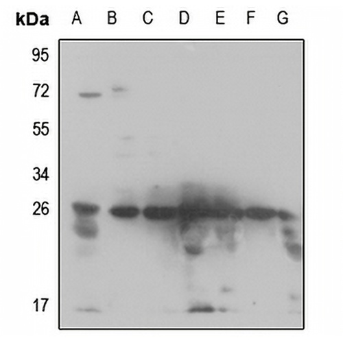 RPS3 Rabbit Polyclonal Antibody