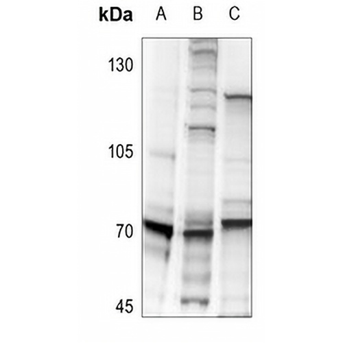 S6K1 (Phospho-S418) Rabbit Polyclonal Antibody