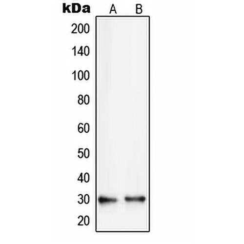 RPS8 Rabbit Polyclonal Antibody