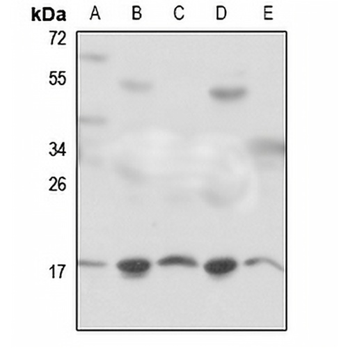 RPS18 Rabbit Polyclonal Antibody