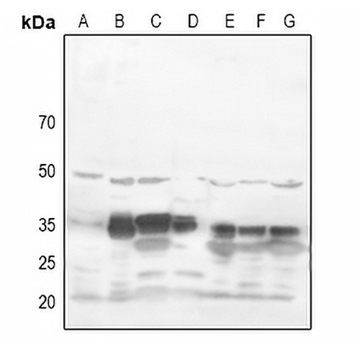 RRAD Rabbit Polyclonal Antibody