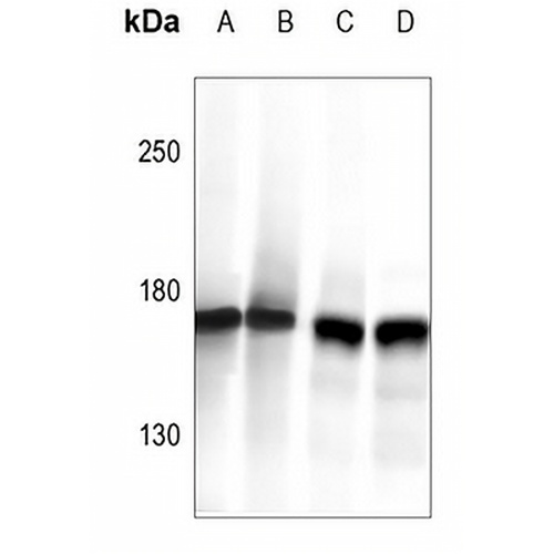 CLIP1 Rabbit Polyclonal Antibody