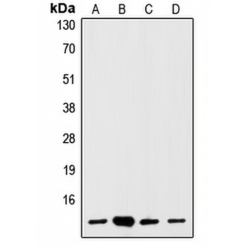 S100-A1 Rabbit Polyclonal Antibody