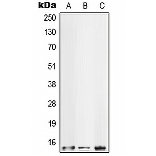S100-A10 Rabbit Polyclonal Antibody