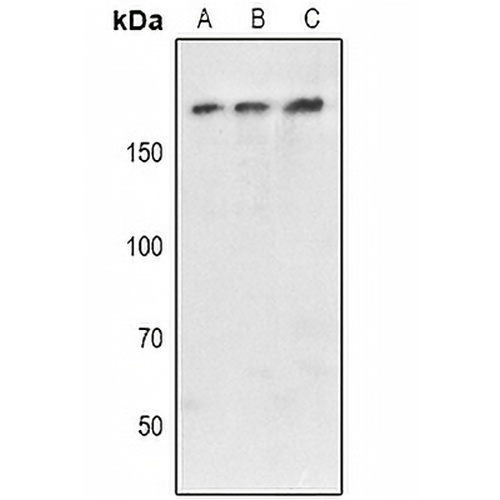 Ataxin 2 Rabbit Polyclonal Antibody