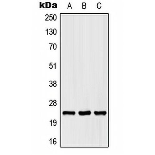 SCN2B Rabbit Polyclonal Antibody
