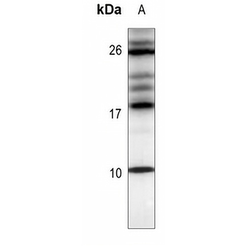 CXCL12 Rabbit Polyclonal Antibody