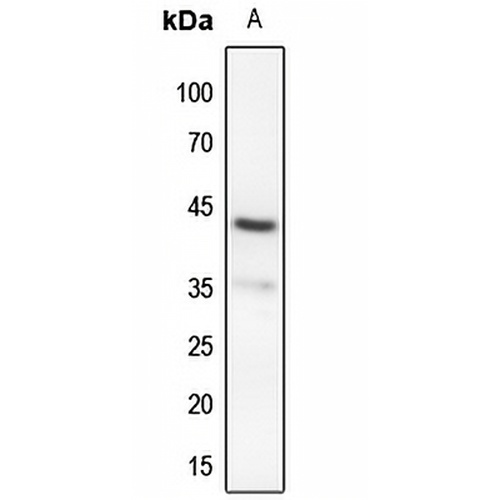 MKK4 (Phospho-S80) Rabbit Polyclonal Antibody