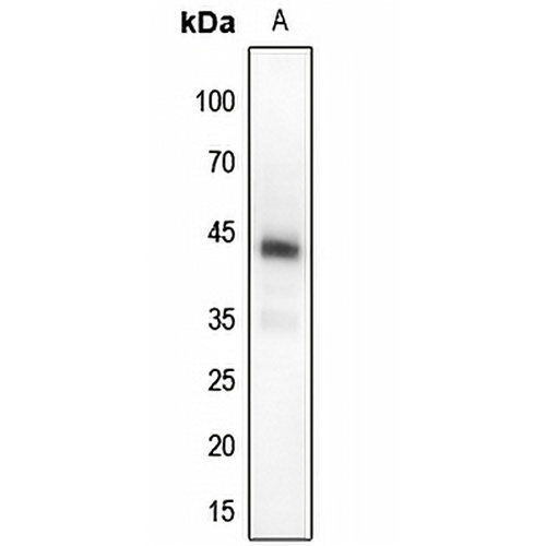 MKK4 (Phospho-T261) Rabbit Polyclonal Antibody
