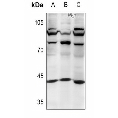 MKK4 Rabbit Polyclonal Antibody
