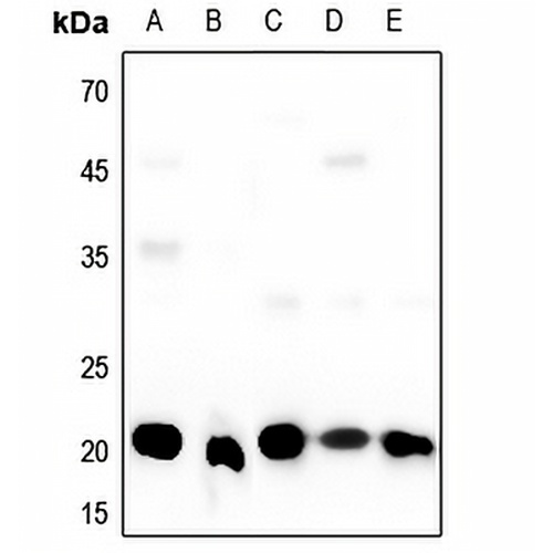 SRSF3 Rabbit Polyclonal Antibody