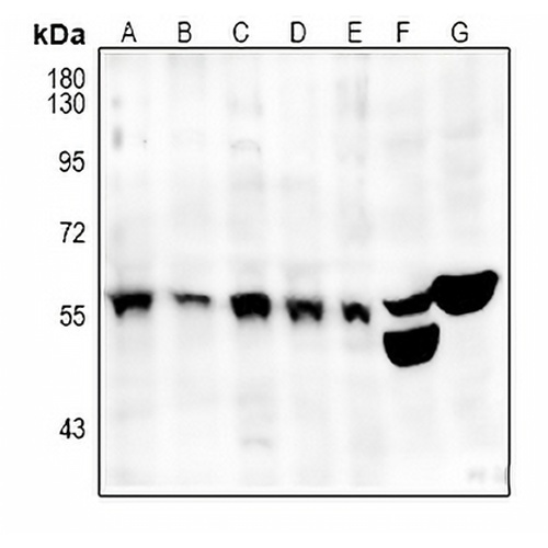 SRSF4 Rabbit Polyclonal Antibody