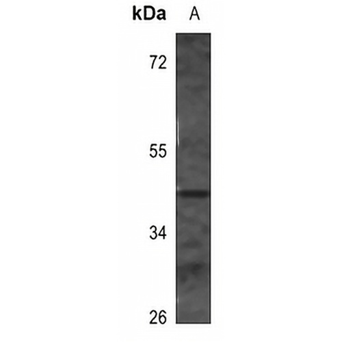Surfactant Protein B Rabbit Polyclonal Antibody