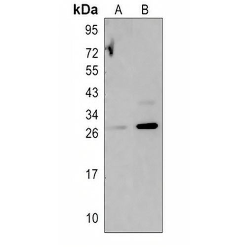 Beta-sarcoglycan Rabbit Polyclonal Antibody