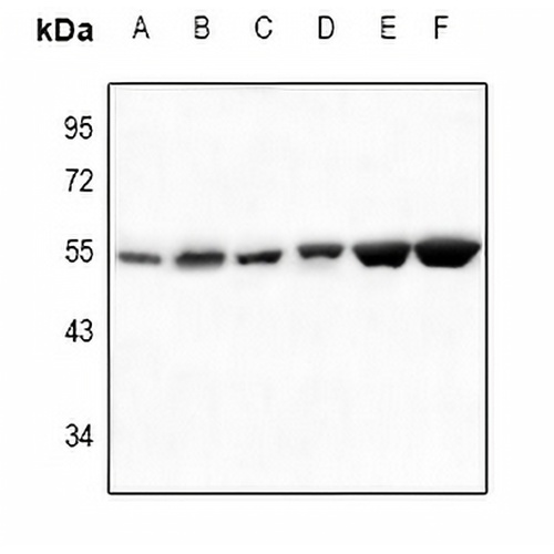 SGK1/2 Rabbit Polyclonal Antibody