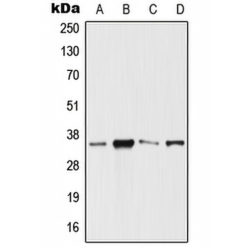 SIX3 Rabbit Polyclonal Antibody