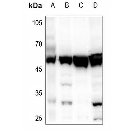 SKP2 Rabbit Polyclonal Antibody