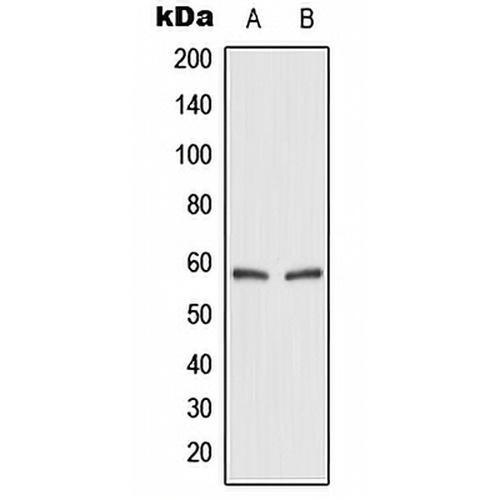 GLUT2 Rabbit Polyclonal Antibody