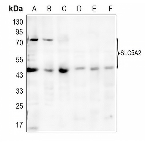 SGLT2 Rabbit Polyclonal Antibody
