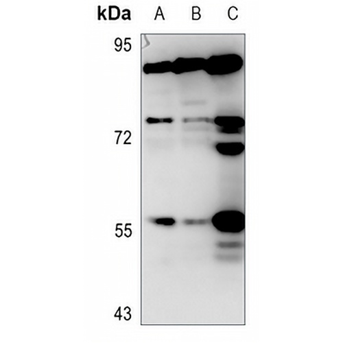 PEPT1 Rabbit Polyclonal Antibody
