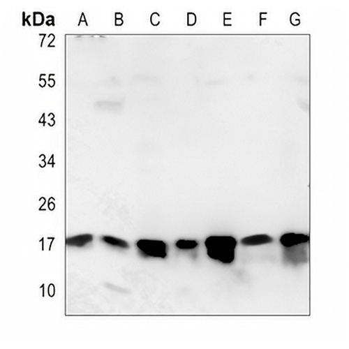 SUMO2/3 Rabbit Polyclonal Antibody