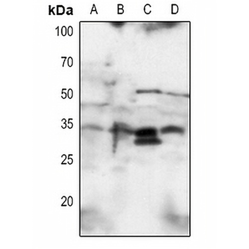 SNAI1 Rabbit Polyclonal Antibody