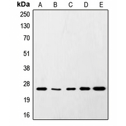 SNAP25 Rabbit Polyclonal Antibody