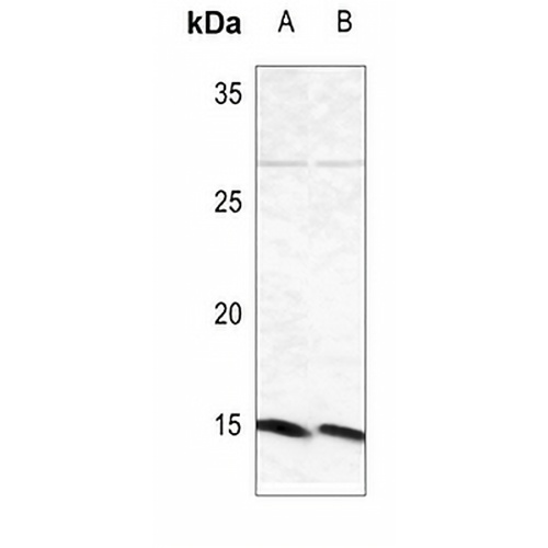 Beta-synuclein Rabbit Polyclonal Antibody