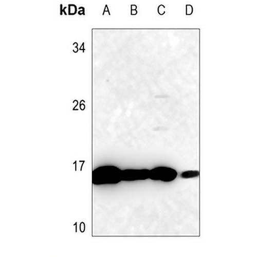 SOD1 Rabbit Polyclonal Antibody