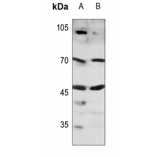 SOX11 Rabbit Polyclonal Antibody