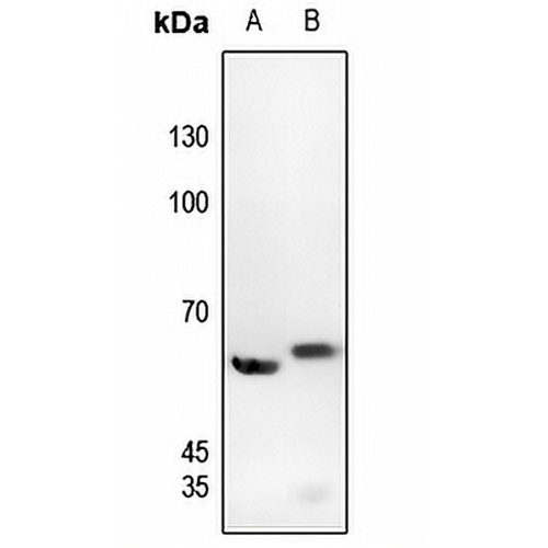 c-SRC (Phospho-Y529) Rabbit Polyclonal Antibody