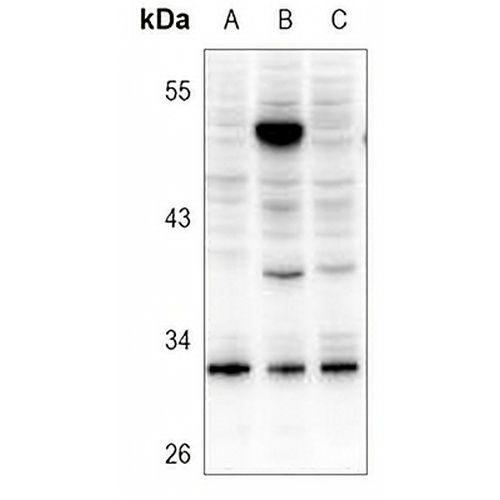 SRD5A1 Rabbit Polyclonal Antibody