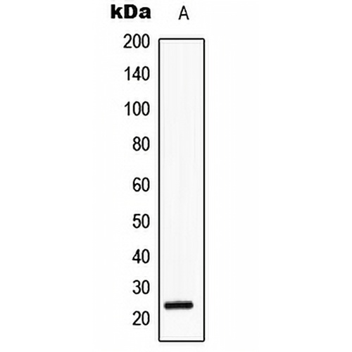 SRY Rabbit Polyclonal Antibody
