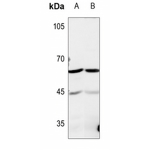 TROVE2 Rabbit Polyclonal Antibody