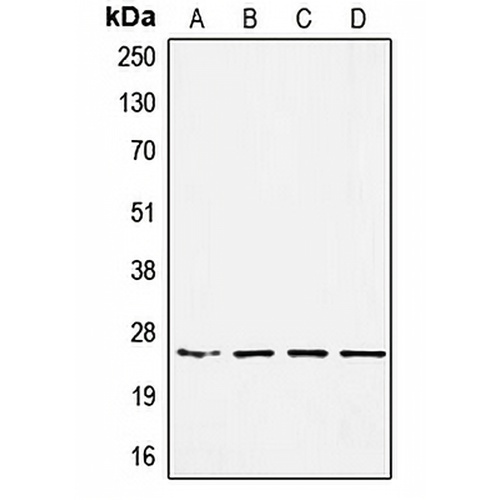 SSX-pan Rabbit Polyclonal Antibody