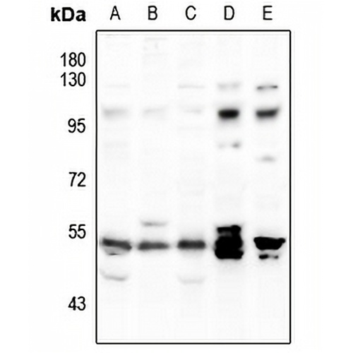 SYT Rabbit Polyclonal Antibody