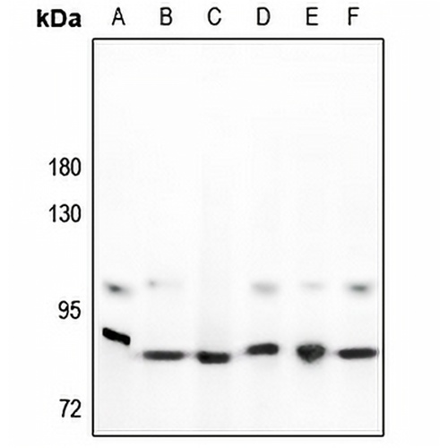 STAT3 Rabbit Polyclonal Antibody